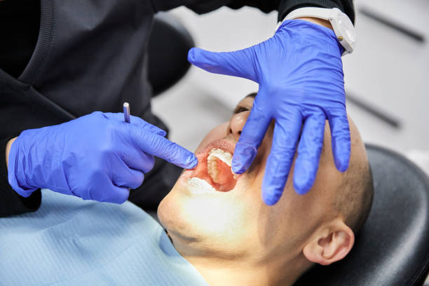Best Emergency Root Canal Treatment in Nutter Fort, WV